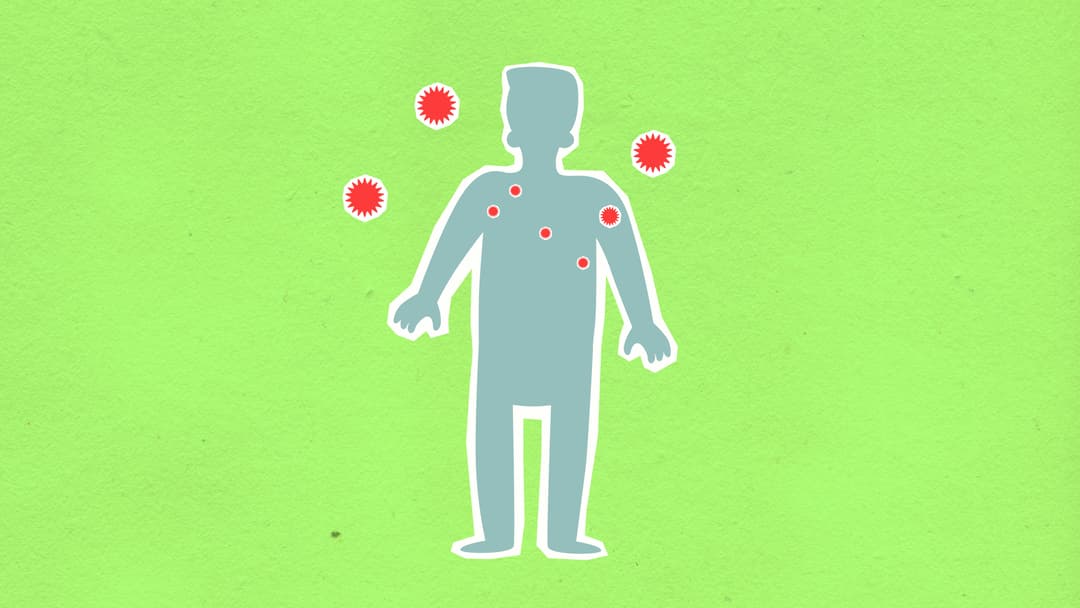 Infecția cu Streptococul A: simptome atipice și riscul de complicații