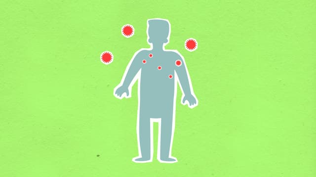 Infecția cu Streptococul A: simptome atipice și riscul de complicații