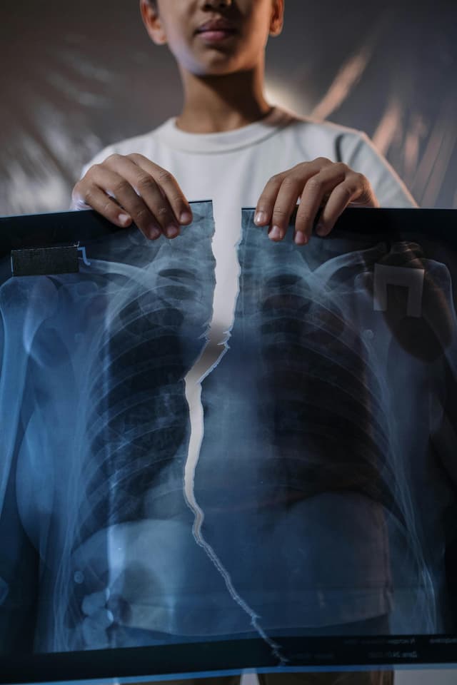 Rubeola la copii: semne clinice, cauze și recomandări medicale